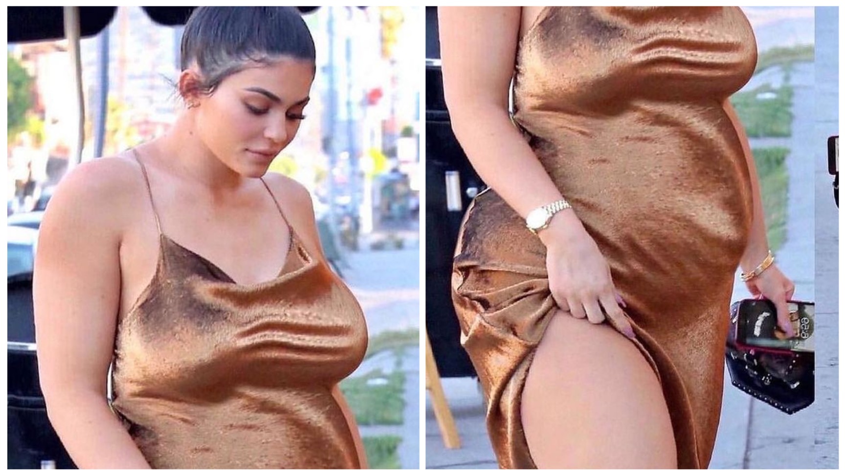 Fetal alcohol syndrome kylie jenner